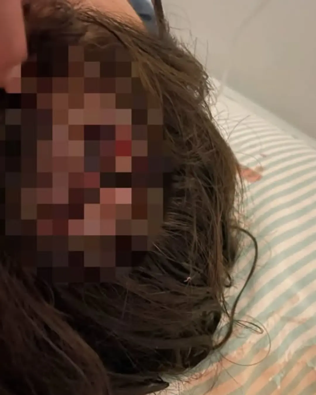 Clevelândia mulher é atacada por pitbull