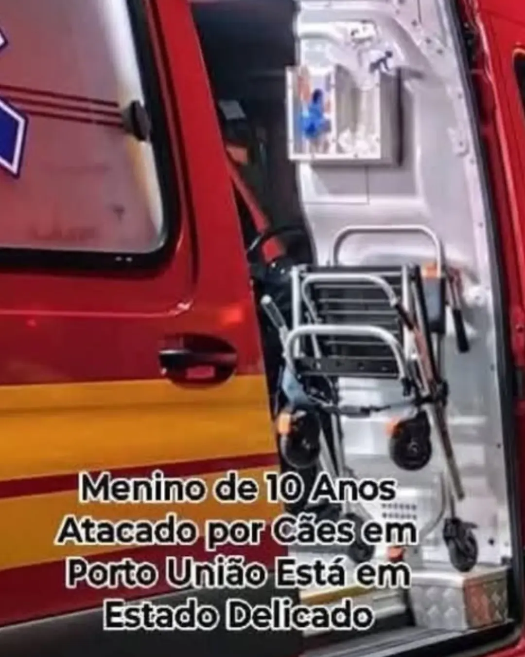 Menino de 10 Anos Atacado por Cães em Porto União Está em Estado Delicado