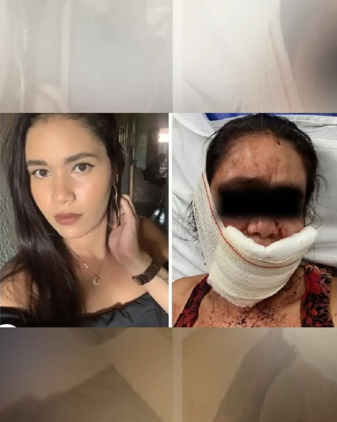 Mulher é enforcada e tem lábios arrancados após rir de namorado.