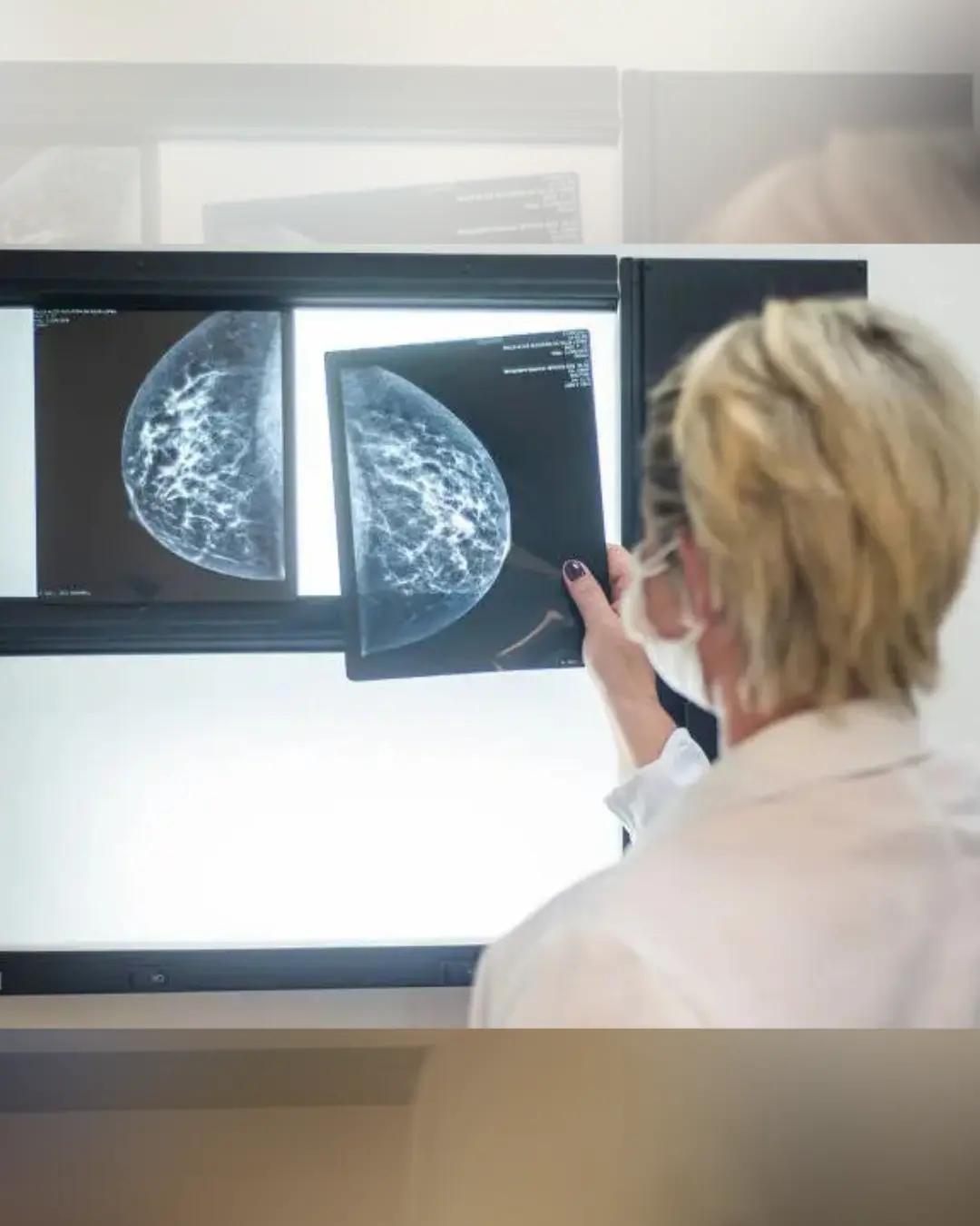 Mutação genética brasileira associada ao câncer afeta 1 em cada 300 no sul e sudeste, aponta estudo