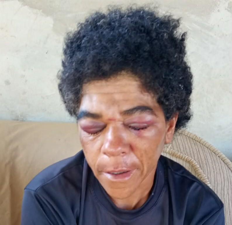 Filha pede justiça pelas agressões que sua mãe sofreu